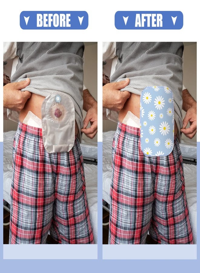 كينغدير ١٠ أغطية لأكياس فغر القولون، مقاومة للماء، غطاء استحمام، خفيفة الوزن، بطانة قابلة للغسل لأكياس فغر القولون مع فتحة قابلة للتعديل، مناسبة للنساء والرجال، للعناية والحماية. - Image 4